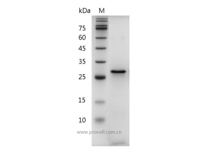 Galectin-3/LGALS3, Human, Recombinant