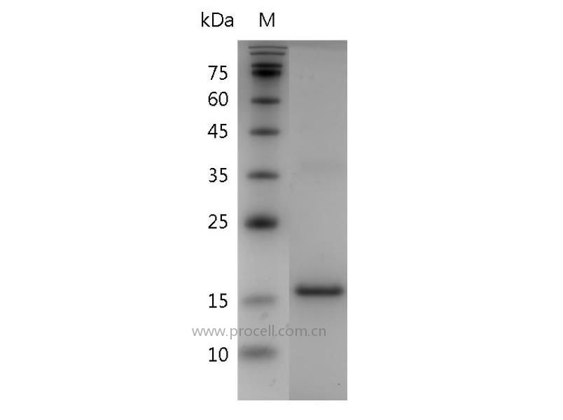 IL-24/MDA-7, Human, Recombinant