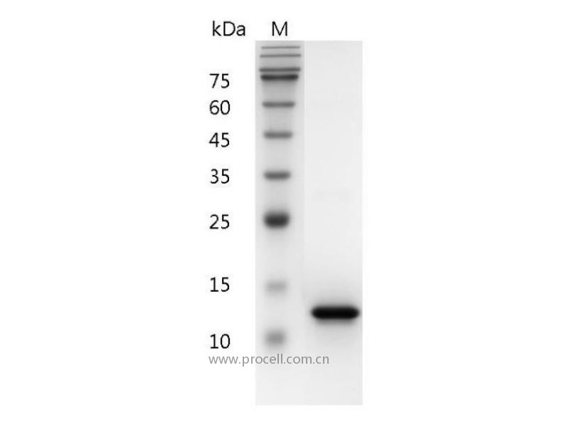 CD40L/TNFSF5/TRAP/CD154, Human, Recombinant