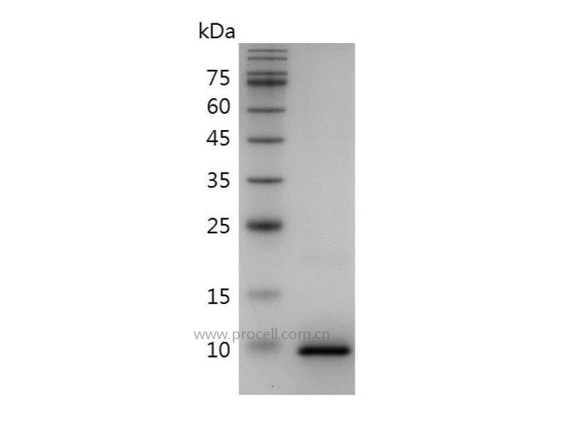 CCL3/MIP-1α/LD78α, Human, Recombinant