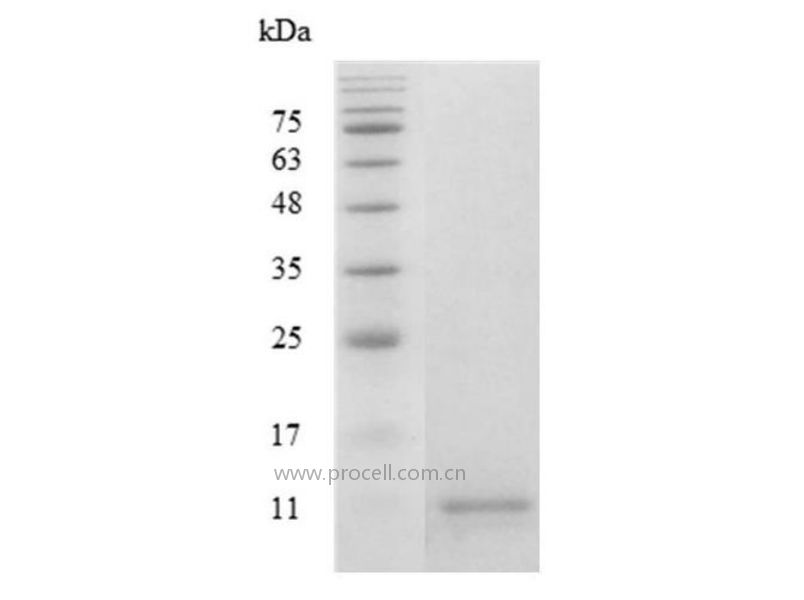 CCL4/MIP-1β/ACT-2, Human, Recombinant