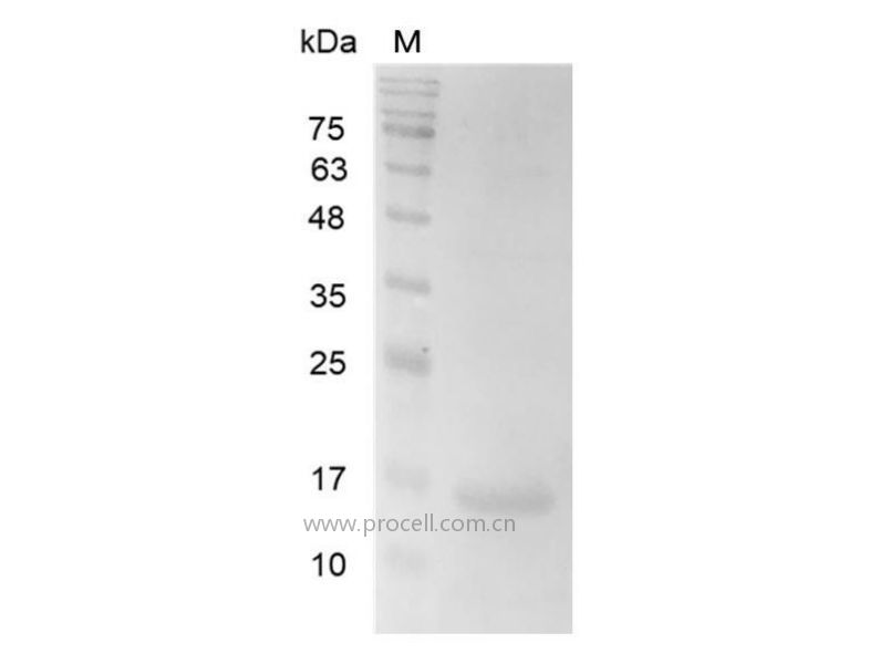 Galectin-2/LGALS2/HL14, Human, Recombinant