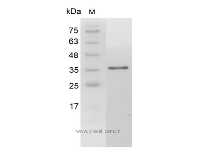 Galectin-4/LGALS4/GAL4/L36LBP, Human, Recombinant