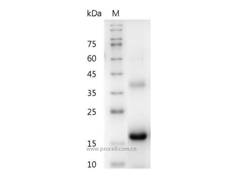 M-CSF/CSF-1/MGI-IM, Mouse, Recombinant