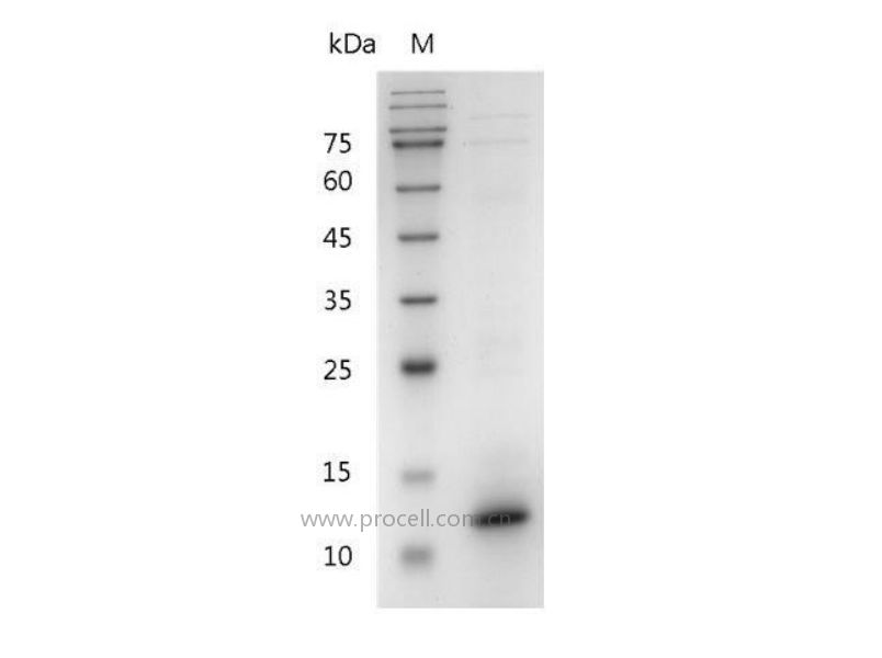 IL-15/IL-T, Mouse, Recombinant