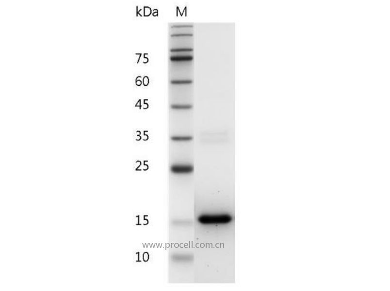 IL-3/HCGFBPA/PSF, Mouse, Recombinant