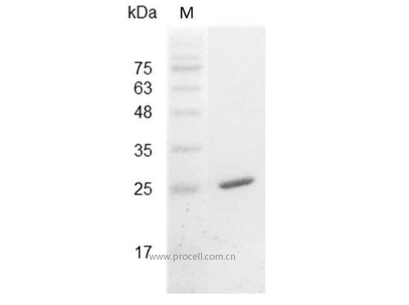 IL-30/IL-27/IL27-A, Mouse, Recombinant