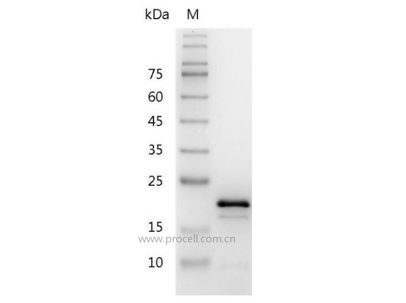 IL-11/AGIF, Mouse, Recombinant