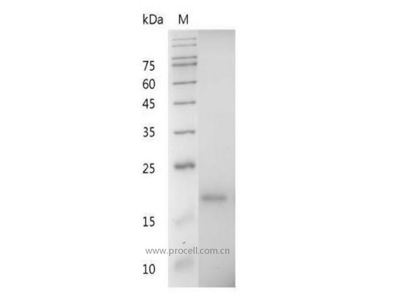 CXCL12/SDF-1, Mouse, Recombinant