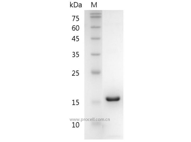 CXCL5/ENA-78, Mouse, Recombinant