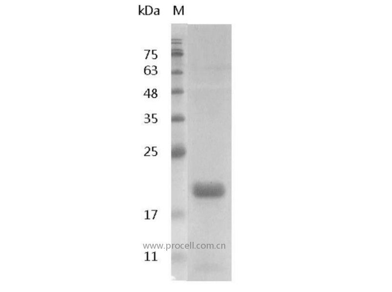 IL-1β/IL1B1/IL1B, Swine, Recombinant