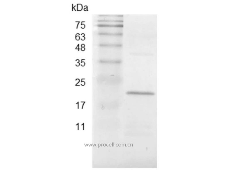 CCL2/MCP-1, Swine, Recombinant