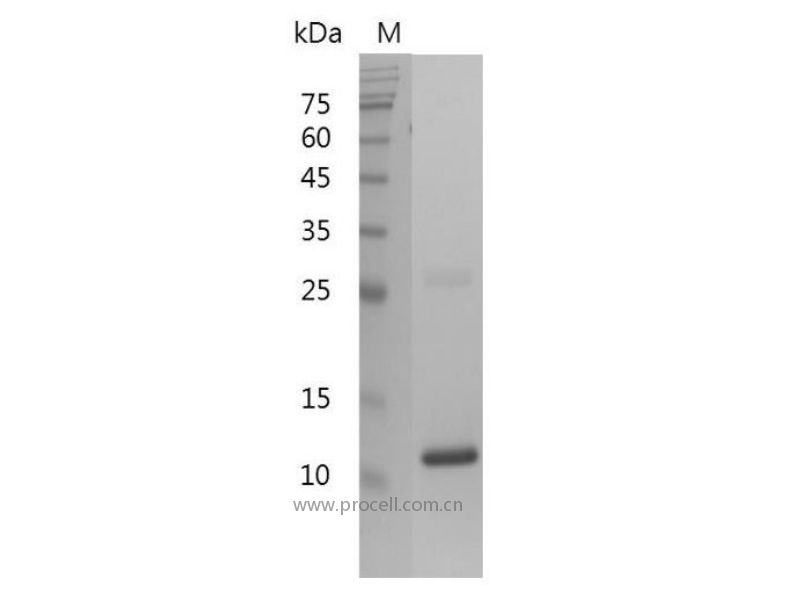 TGFβ 1/TGFB1, Human, Recombinant