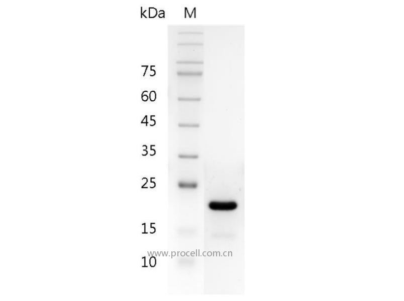 IL-11/AGIF, Human, Recombinant