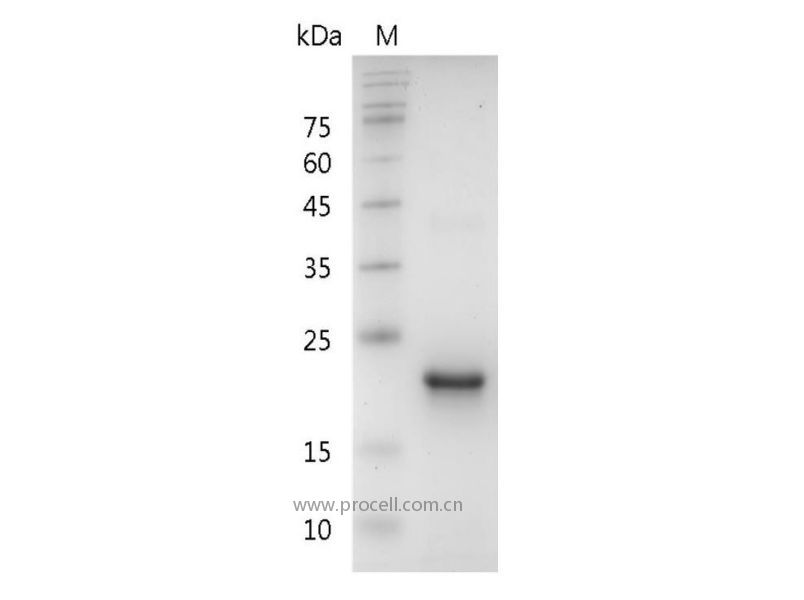 TPO/MGDF/THPO, Human, Recombinant