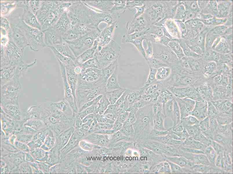 769-P (人肾细胞腺癌细胞) (STR鉴定正确)