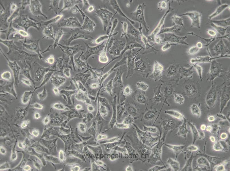 BT-549 (人乳腺管癌细胞) (STR鉴定正确)