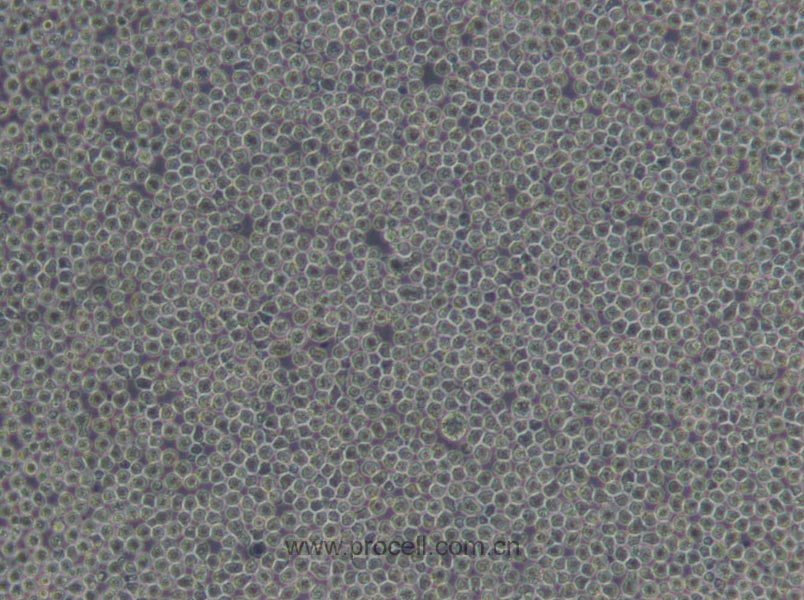 CA46 (人Burkitt's淋巴瘤细胞) (STR鉴定正确)