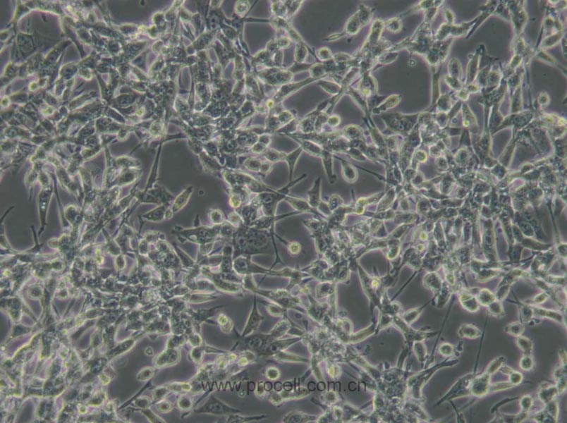 CT26.WT (小鼠结肠癌细胞) (STR鉴定正确)