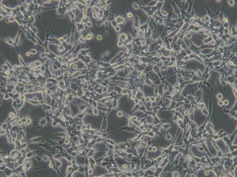 CT26.WT (小鼠结肠癌细胞) (STR鉴定正确)