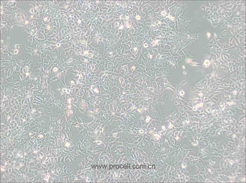 HCC827 (人非小细胞肺癌细胞) (STR鉴定正确)