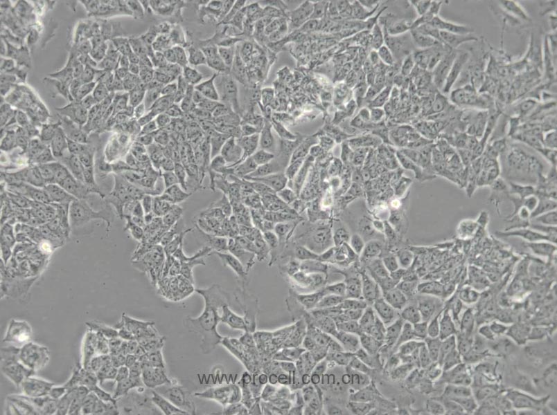 HCT-15 (人结直肠腺癌细胞) (STR鉴定正确)