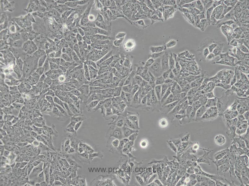 HCT-15 (人结直肠腺癌细胞) (STR鉴定正确)