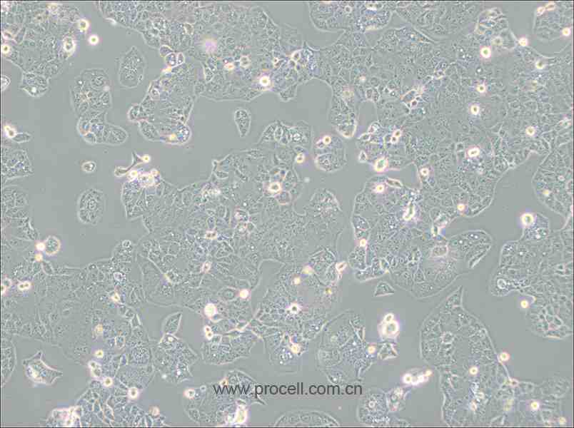 HEC-1-A (人子宫内膜腺癌细胞) (STR鉴定正确)