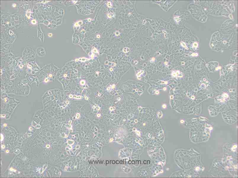 HEC-1-A (人子宫内膜腺癌细胞) (STR鉴定正确)