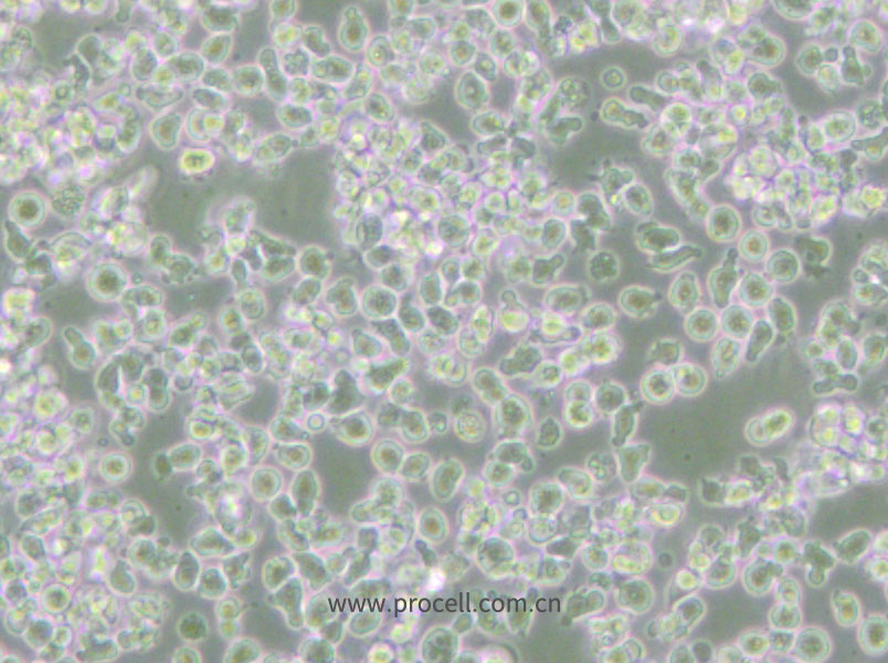 HMy2.CIR (人B淋巴母细胞) (STR鉴定正确)