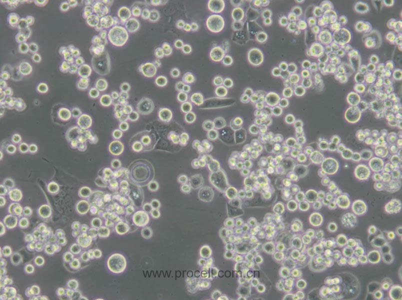 MDA-MB-453 (人乳腺癌细胞) (STR鉴定正确)