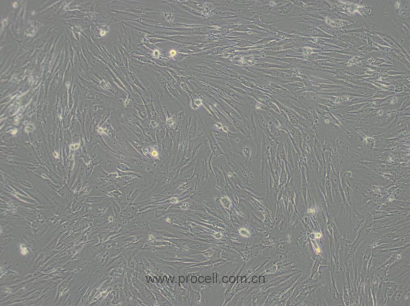 MRC-5 (人胚肺细胞) (STR鉴定正确)