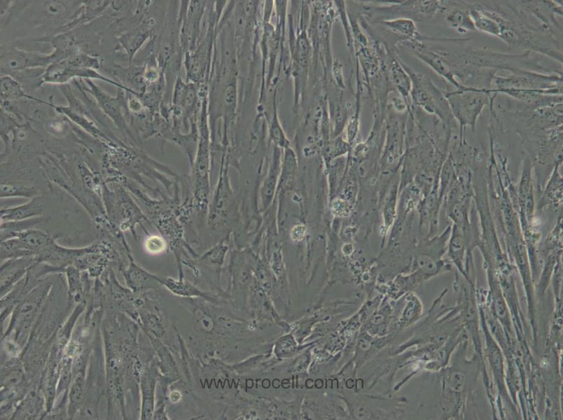 MRC-5 (人胚肺细胞) (STR鉴定正确)