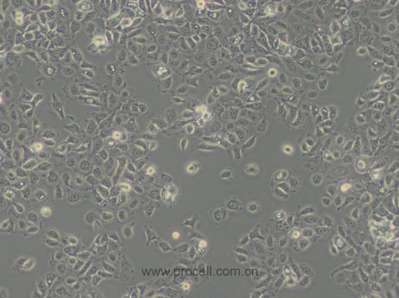 NCI-H292 (人肺癌细胞(淋巴结转移)) (STR鉴定正确)