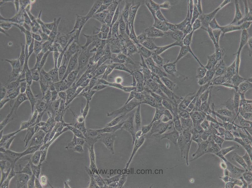 NIH/3T3 (小鼠胚胎细胞) (STR鉴定正确)