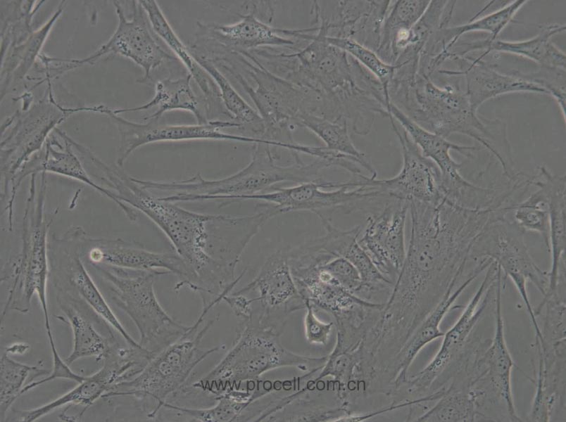 OP9 (小鼠骨髓基质细胞) (STR鉴定正确)