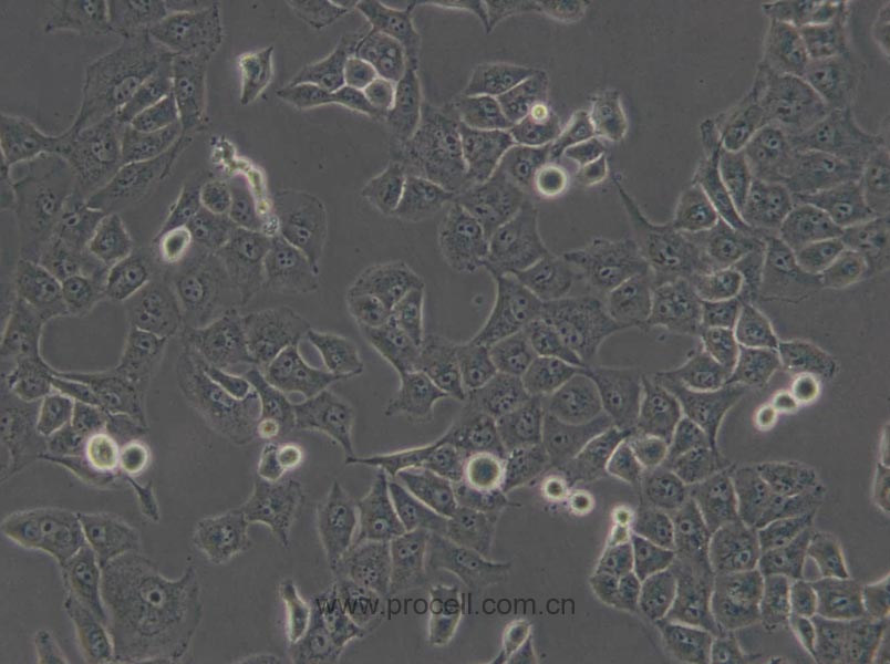 PANC-1 (人胰腺癌细胞) (STR鉴定正确)