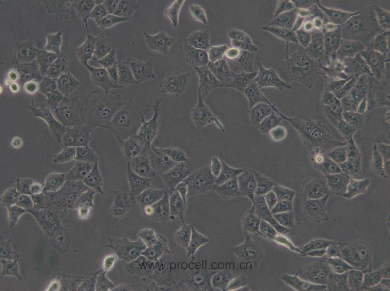 PANC-1 (人胰腺癌细胞) (STR鉴定正确)