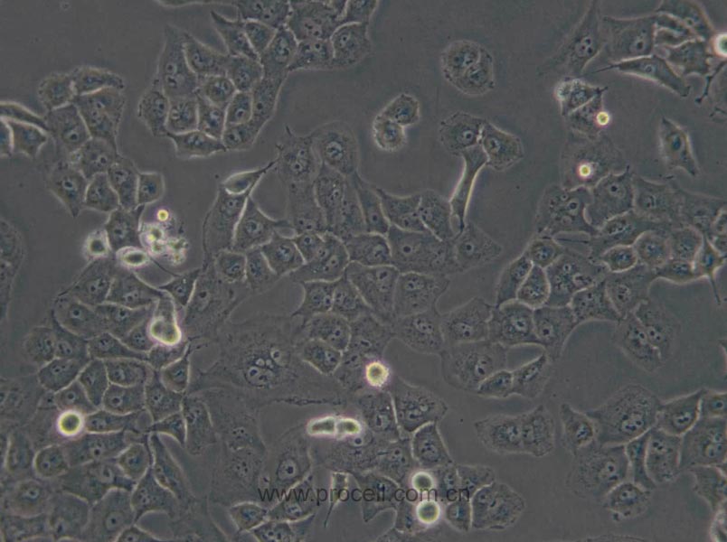 PANC-1 (人胰腺癌细胞) (STR鉴定正确)