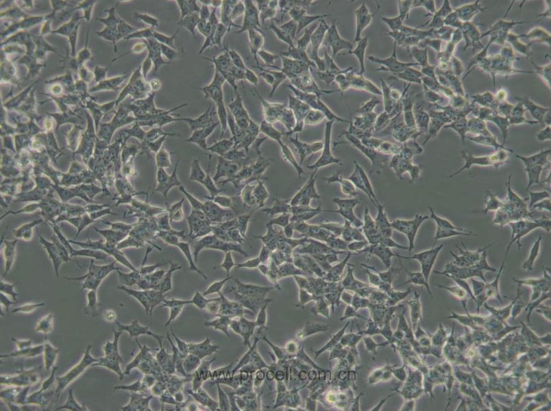 SH-SY5Y [SHSY-5Y] (人神经母细胞瘤细胞) (STR鉴定正确)