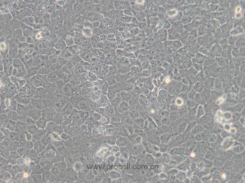 T24 [T-24] (人膀胱移行细胞癌细胞) (STR鉴定正确)