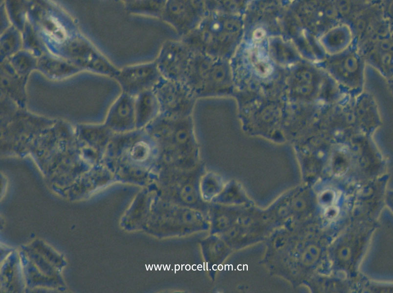 NCI-H1395 (人肺腺癌细胞) (STR鉴定正确)