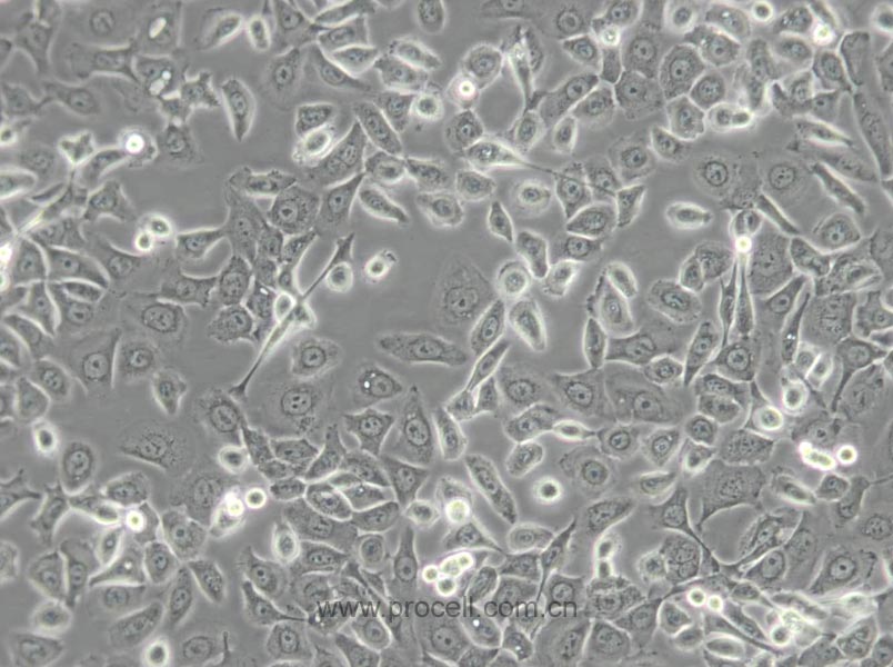 HCC 94 [HCC941122] (人子宫鳞癌细胞(高分化)) (STR鉴定正确)