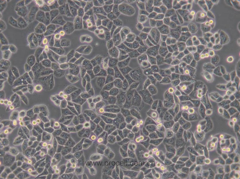 MDA-MB-468 (人乳腺癌细胞) (STR鉴定正确)