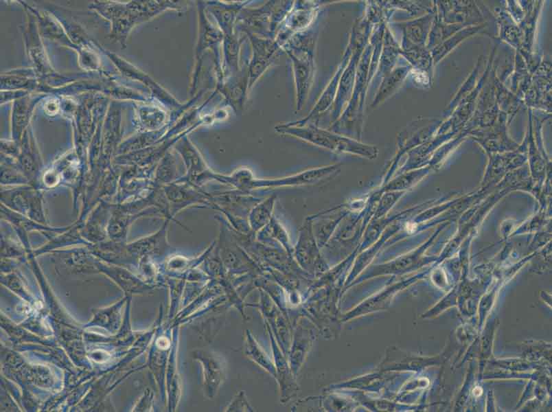 NCI-H1975 (人肺腺癌细胞) (STR鉴定正确)