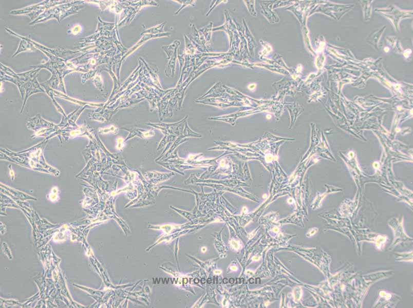 NCI-H1975 (人肺腺癌细胞) (STR鉴定正确)