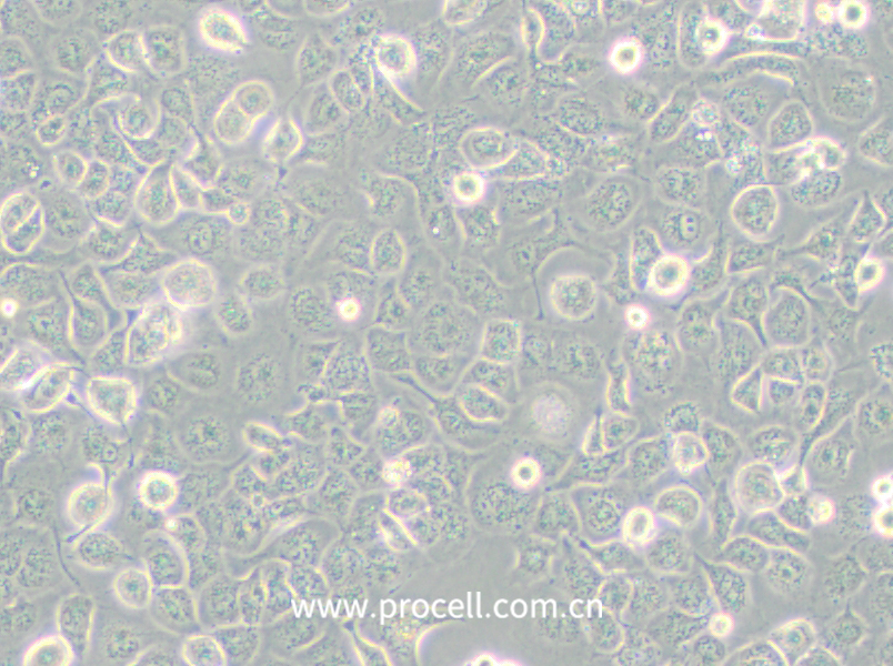 NCI-H661 (人大细胞肺癌细胞) (STR鉴定正确)