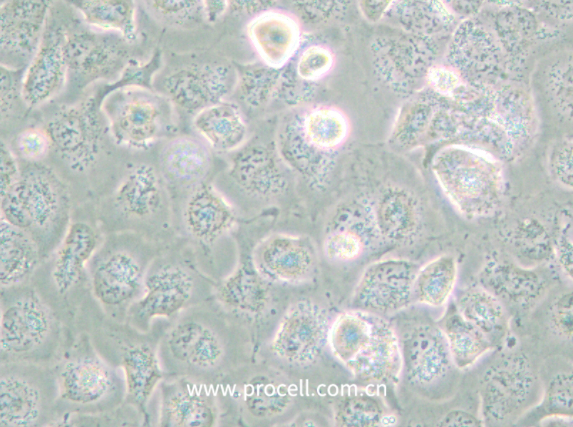 NCI-H661 (人大细胞肺癌细胞) (STR鉴定正确)