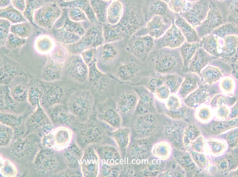 NCI-H661 (人大细胞肺癌细胞) (STR鉴定正确)