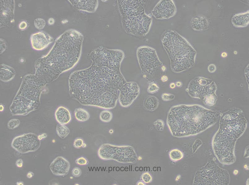 SW1116 (人结肠腺癌细胞) (STR鉴定正确)